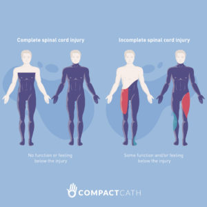 Spinal Cord Injuries: Impact on the Bladder & Bowel - CompactCath